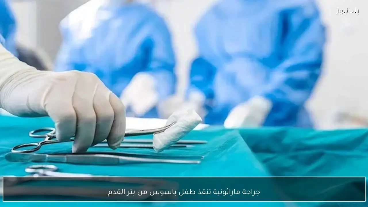 جراحة ماراثونية تنقذ طفل باسوس من بتر القدم