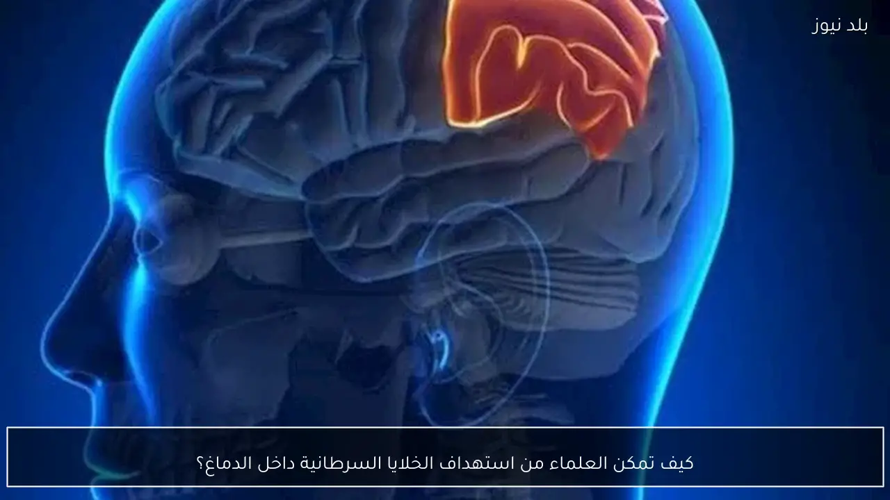 كيف تمكن العلماء من استهداف الخلايا السرطانية داخل الدماغ؟